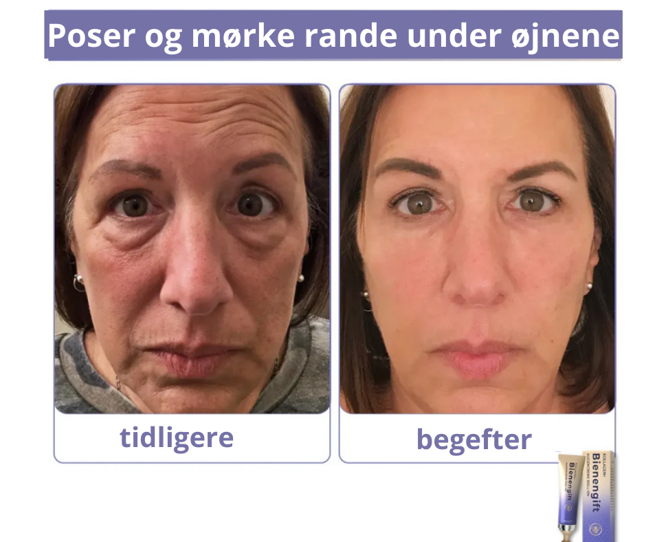 BioBee™ – Styrk din hud med naturens kraft