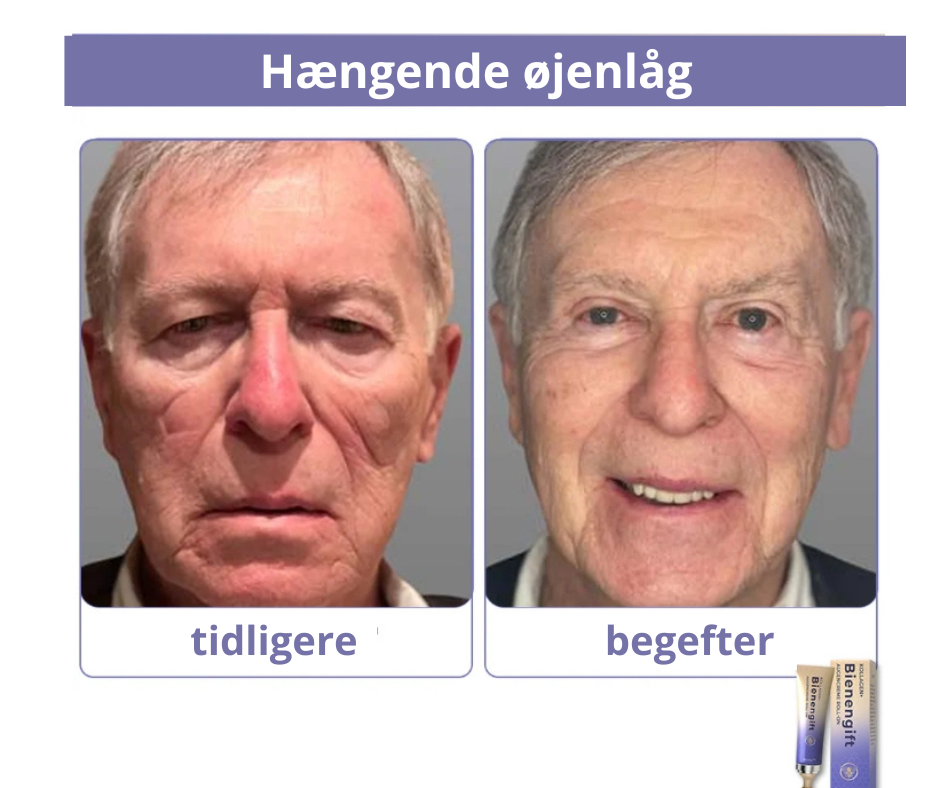 BioBee™ – Styrk din hud med naturens kraft