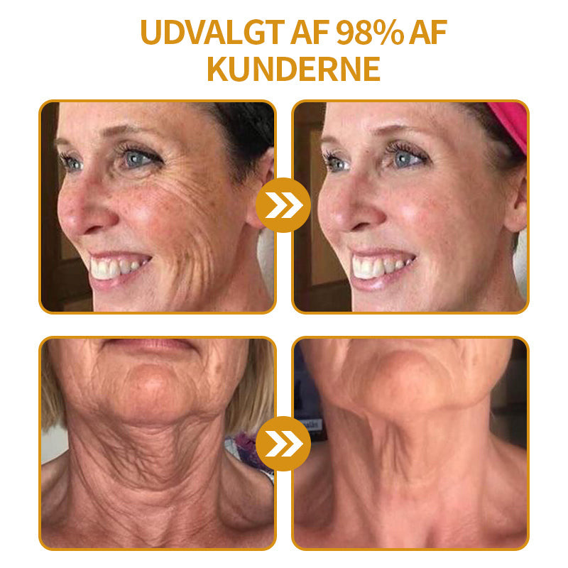 Anti-Rynke™ Botox Bee Venom Wrinkle Removal Cream