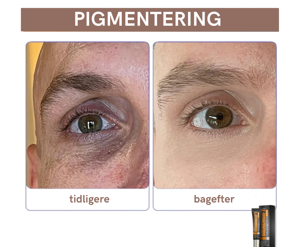 BeeVital™ – Anti-Træthed & Mørke Rande