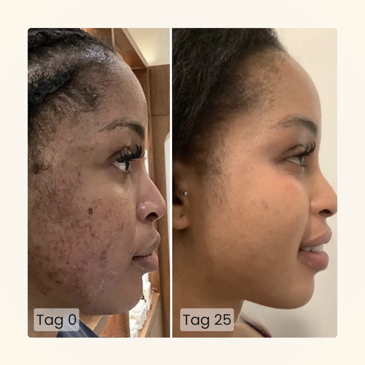 Gloomi® Skin Essence Bar (pakke med 2) + Rutinesæt