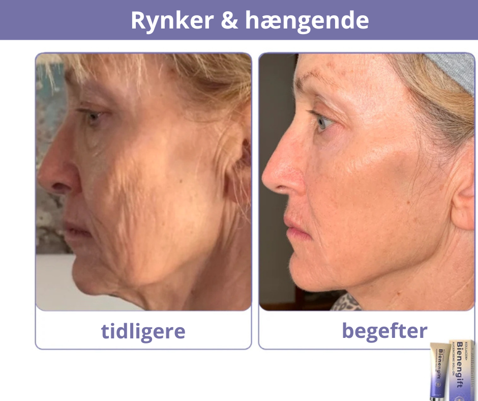 BioBee™ – Styrk din hud med naturens kraft