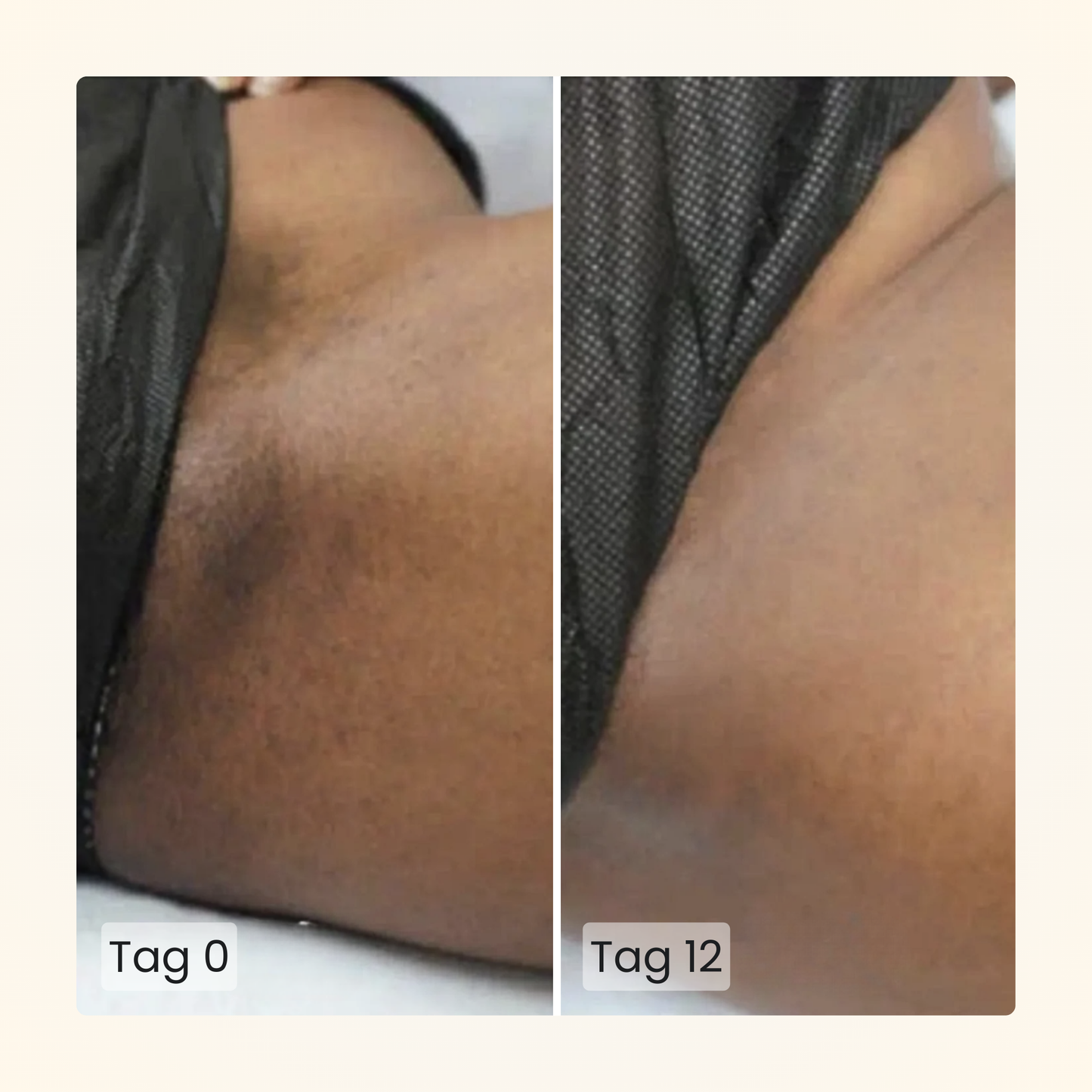 Gloomi® Skin Essence Bar (pakke med 2) + Rutinesæt