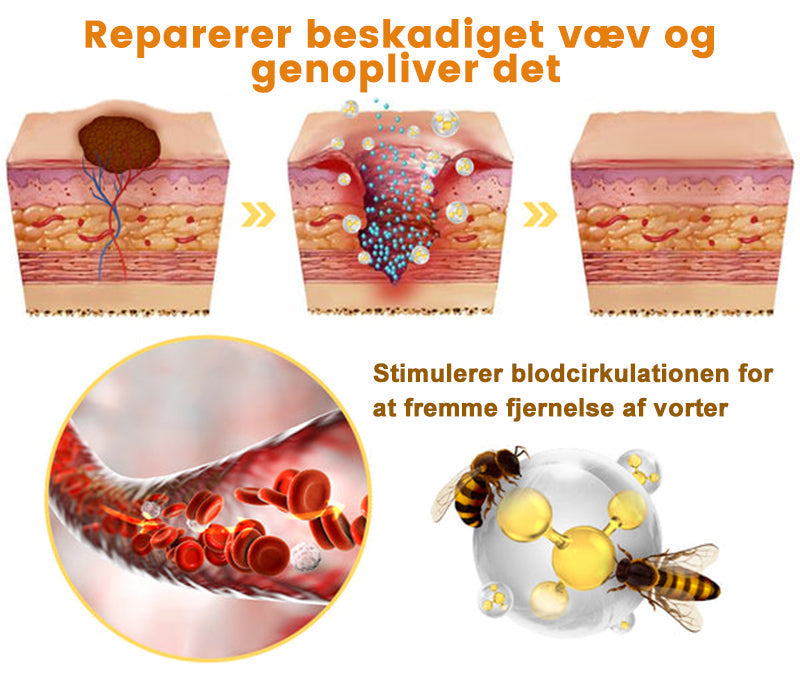 SkinPure™ – Spray til Urenheder & Vorter