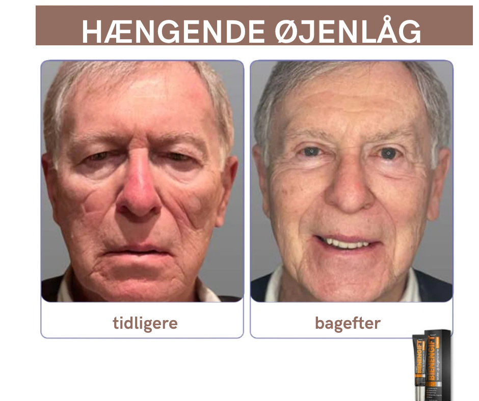 BeeVital™ – Anti-Træthed & Mørke Rande