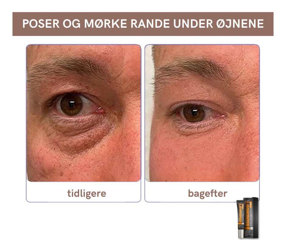 BeeVital™ – Anti-Træthed & Mørke Rande