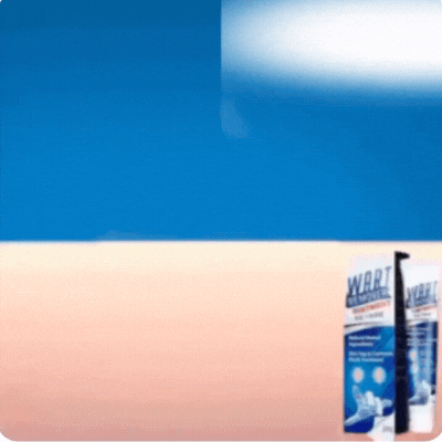 Wratvrij™ Vortefjerner - Fjern alle dine vorter smertefrit på kun 7 dage!