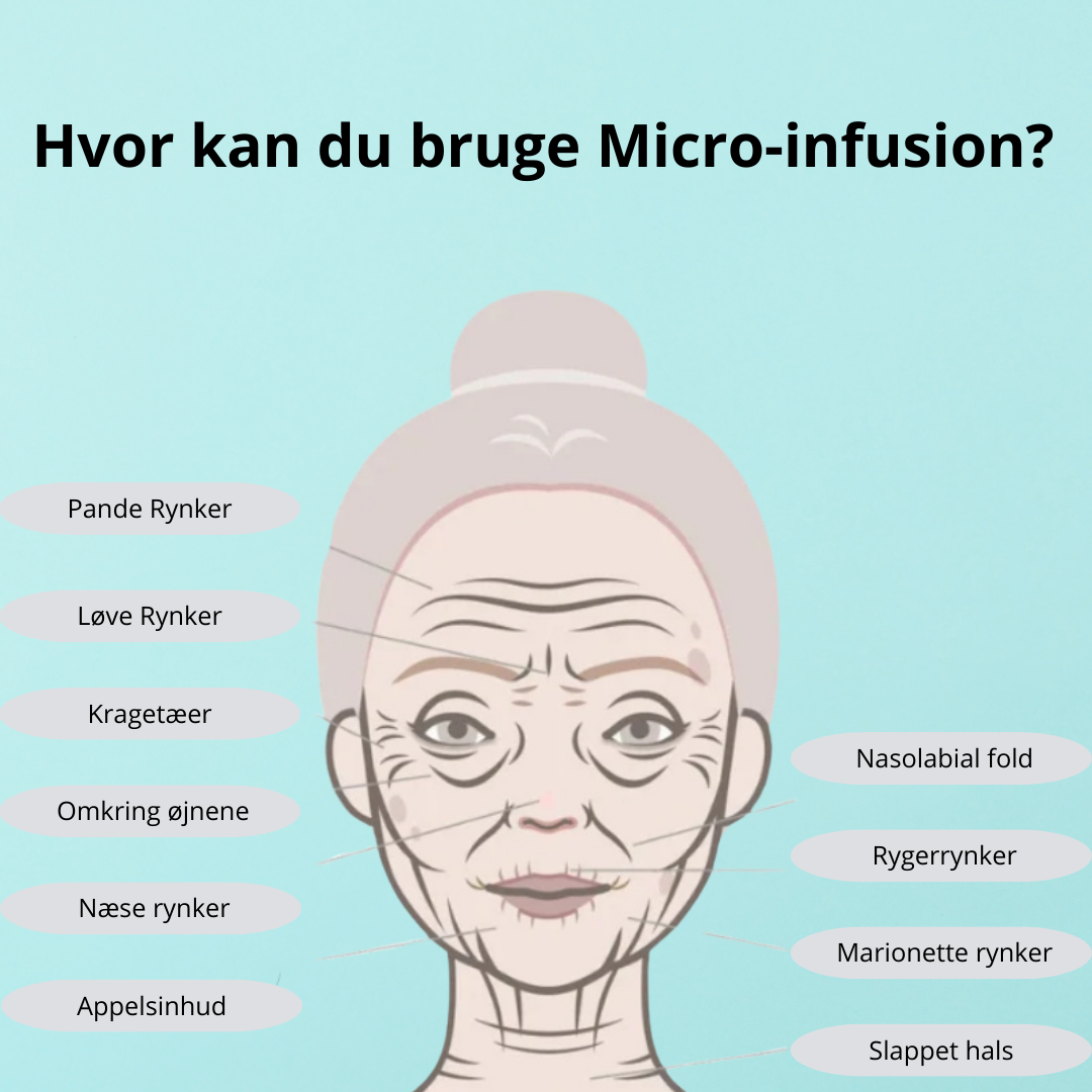 Micro-Infusion Løfte Kit™