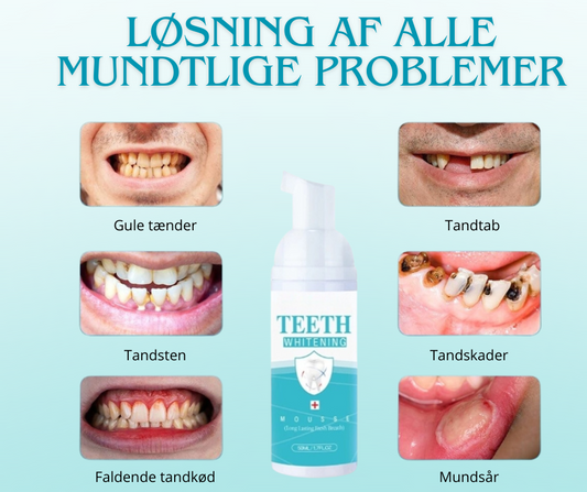 TandSkum™ | Skånsom Tandblegningsmousse