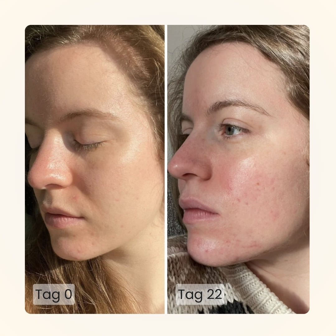 Gloomi® Skin Essence Bar (pakke med 2) + Rutinesæt