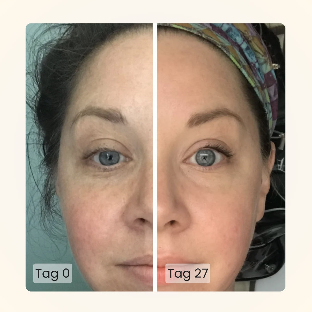 Gloomi® Skin Essence Bar (pakke med 2) + Rutinesæt