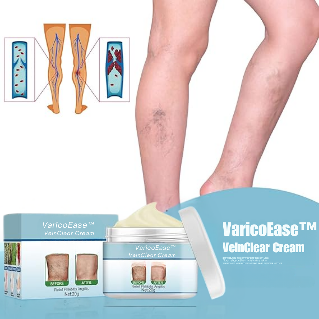 VaricoEase™ - VeinClear Cream - Reducerer synligt åreknuder og hjælper dig med at få glatte, sunde ben på bare 7 dage! (1+1 GRATIS)