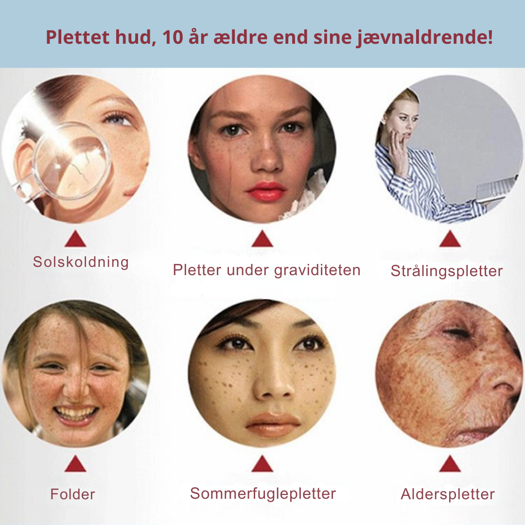 MærkeVæk™ – Fjern pletter & mærker på få dage