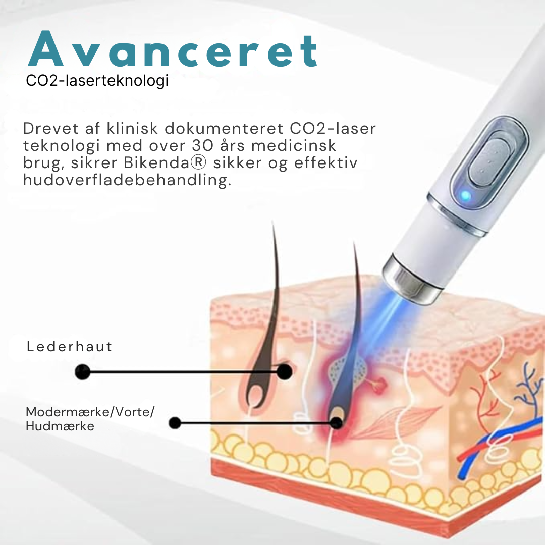 Hidone™ Ikke-invasiv laserpen til fjernelse af modermærker og vorter