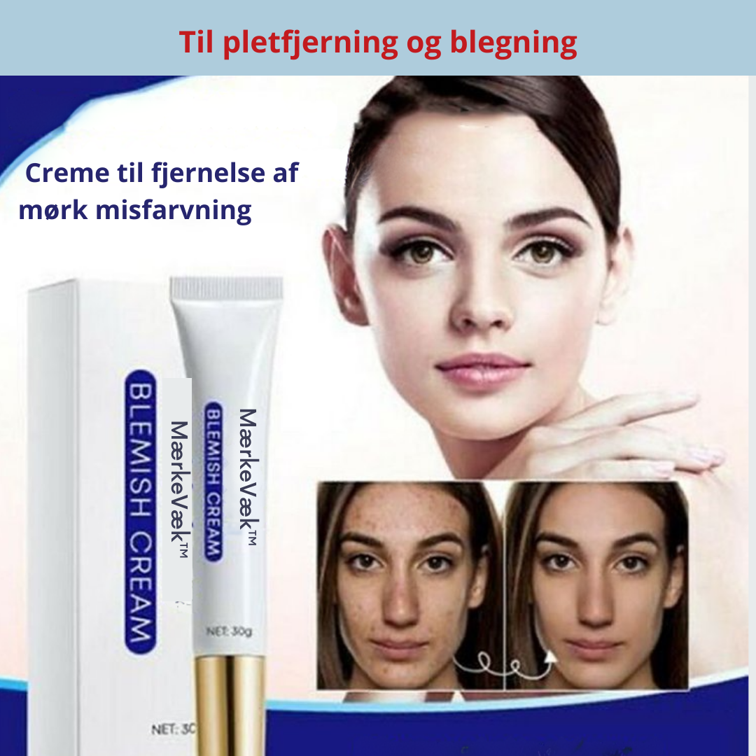 MærkeVæk™ – Fjern pletter & mærker på få dage