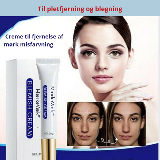 MærkeVæk™ – Fjern pletter & mærker på få dage