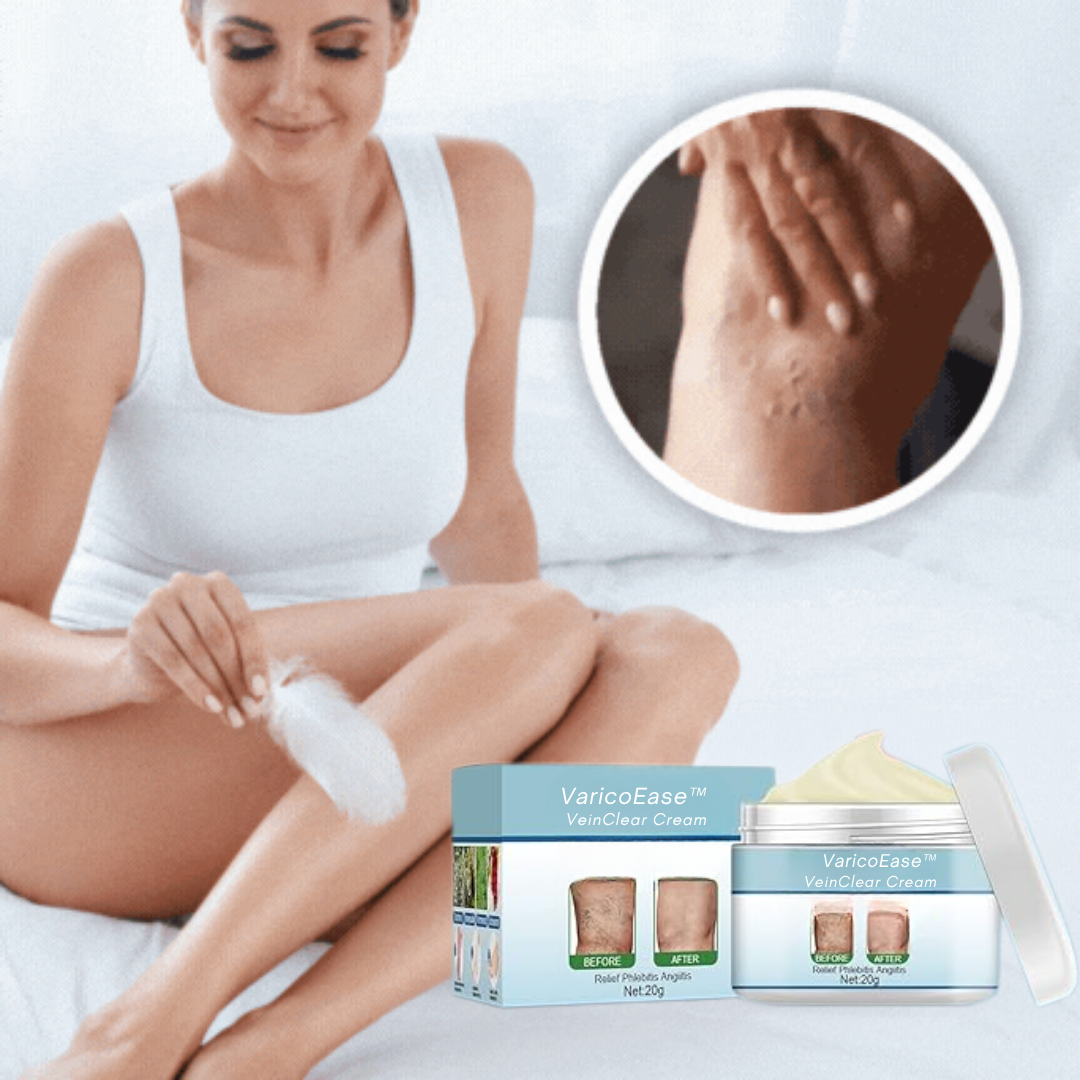 VaricoEase™ - VeinClear Cream - Reducerer synligt åreknuder og hjælper dig med at få glatte, sunde ben på bare 7 dage! (1+1 GRATIS)
