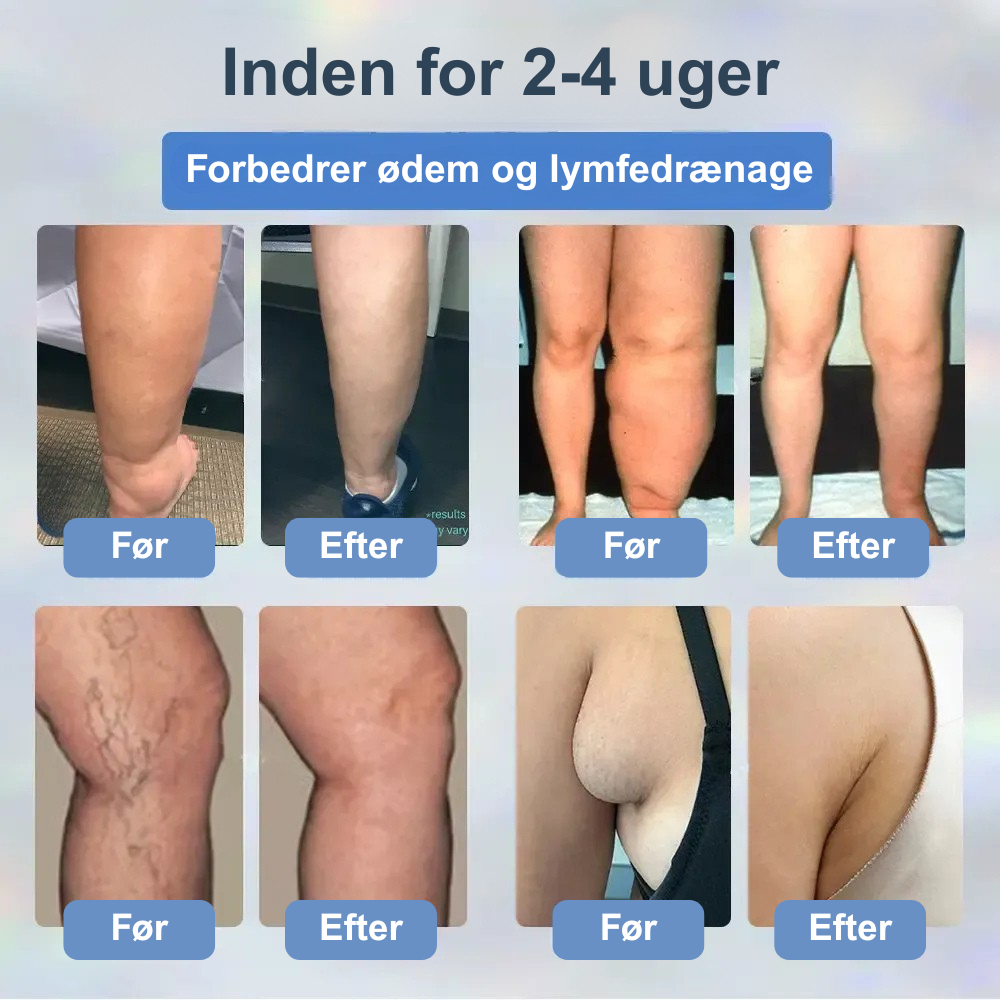 Cvreoz® – Afgiftende urtecreme med sort kommen