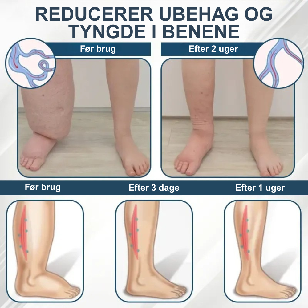 Cvreoz® – Afgiftende urtecreme med sort kommen