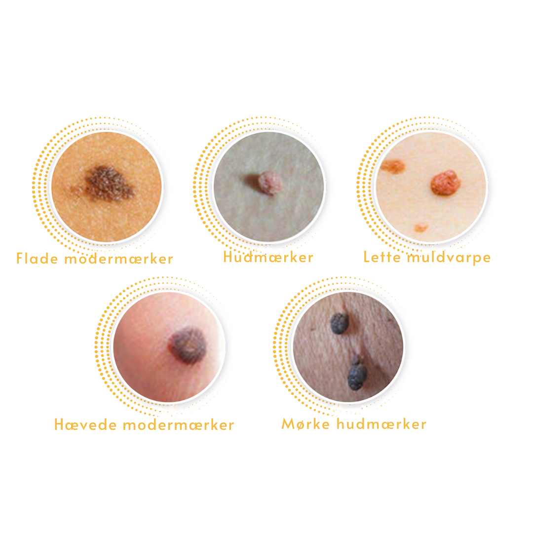 RenHud™ Gel – Klar hud på kun 7 dage