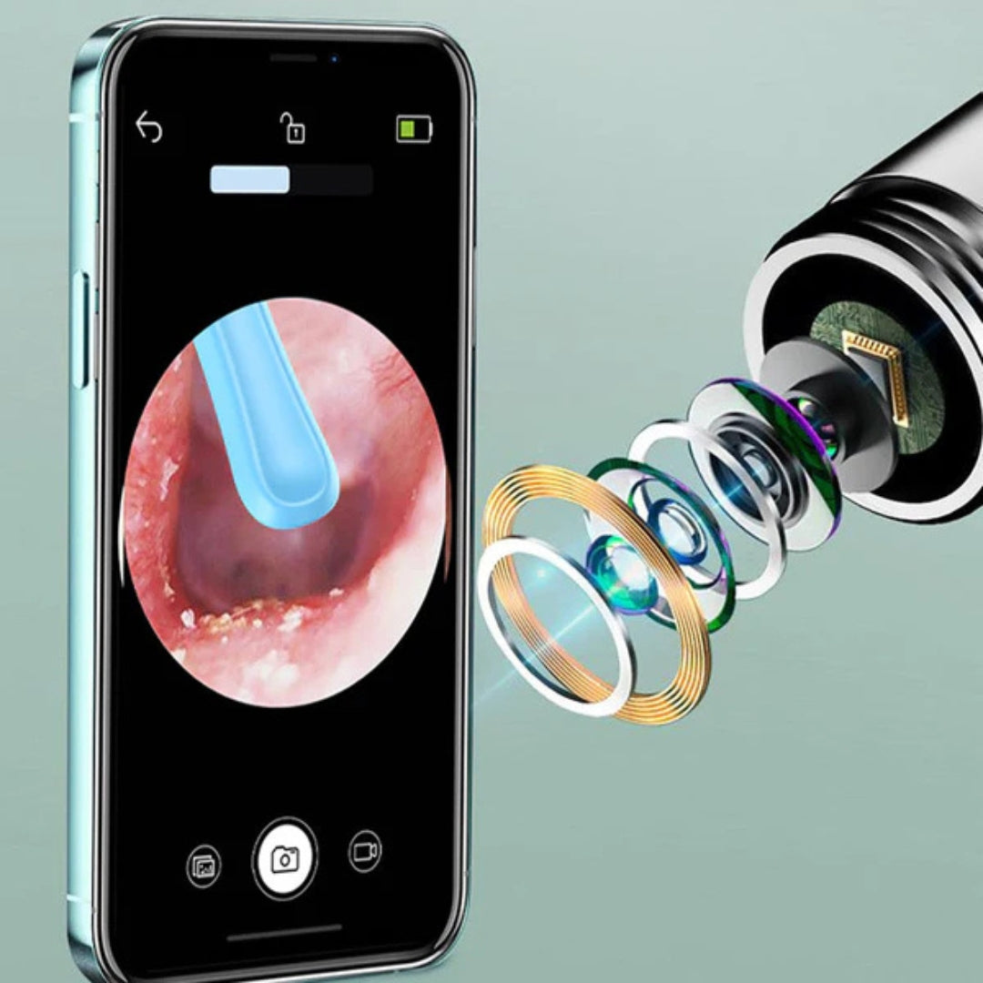 OtoPure™ – Avanceret Ørerens med HD-kamera for Maksimal Præcision!
