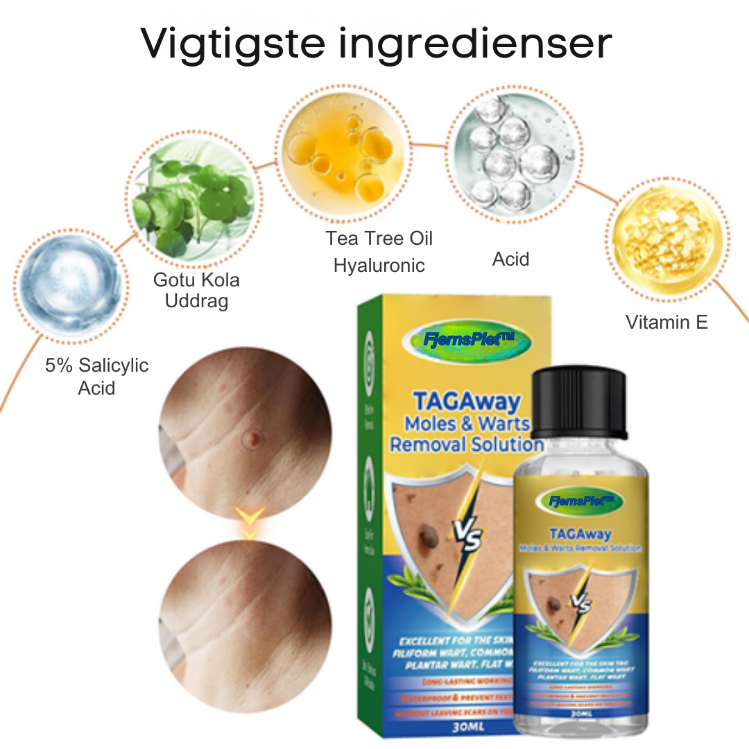 FjernsPlet™ – Effektiv behandling på 7 dage