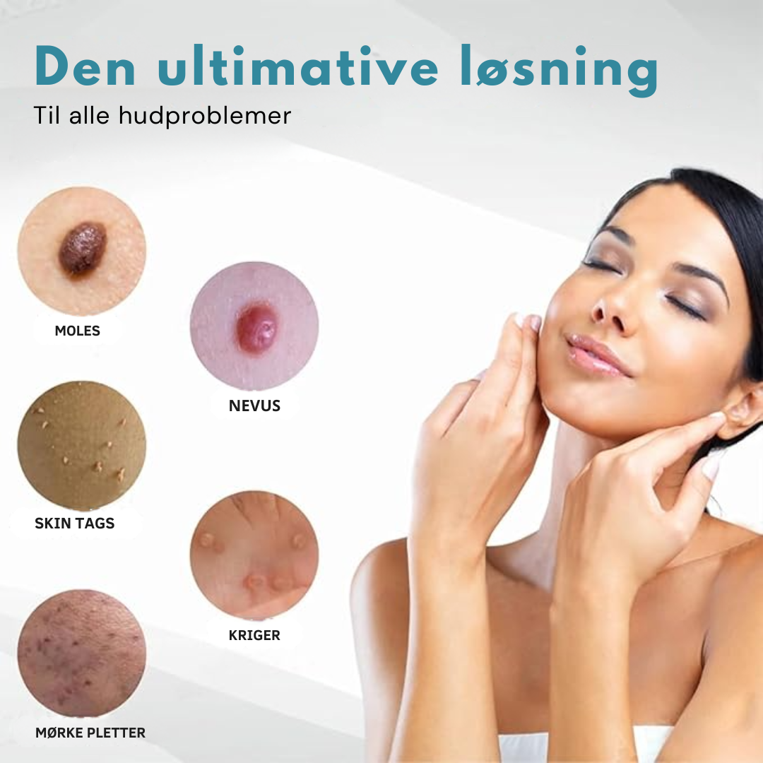 Hidone™ Ikke-invasiv laserpen til fjernelse af modermærker og vorter