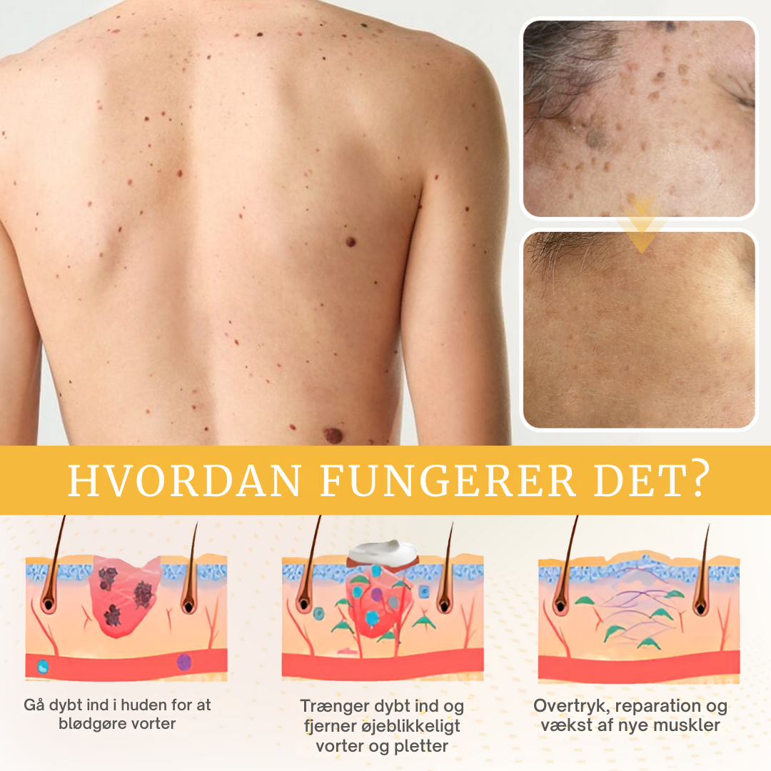 RenHud™ Gel – Klar hud på kun 7 dage