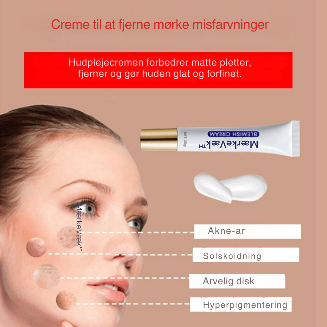 MærkeVæk™ – Fjern pletter & mærker på få dage