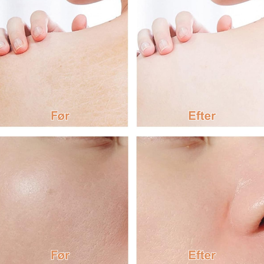 DerolStick™ – Naturlig creme med retinol og hyaluronsyre