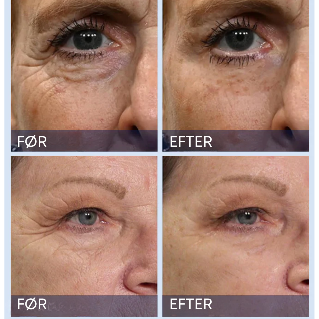 Furzero UngdomsBoost Elixer™ | Forynger din hud og giver et øjeblikkeligt løft