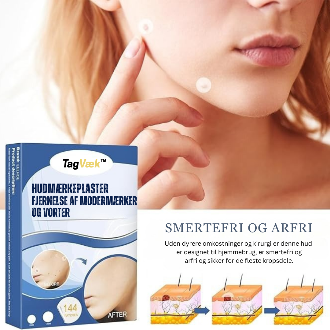 TagVæk™ – Fjern hudmærker på kun 5 dage