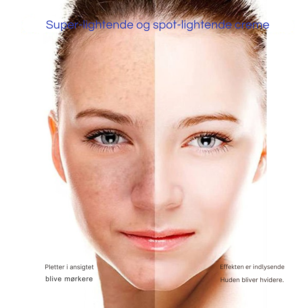 MærkeVæk™ – Fjern pletter & mærker på få dage