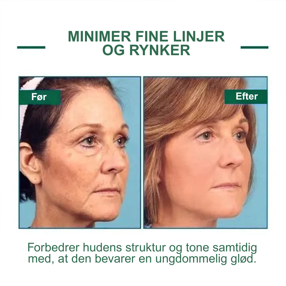 Eelhoe™ – Opstrammende og regenererende serum