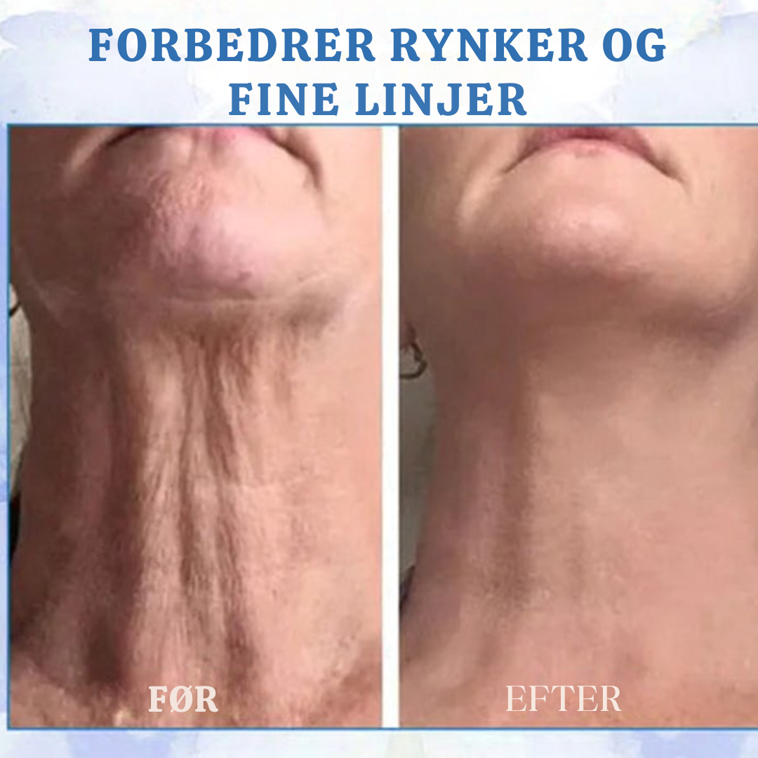 VitaLøft V2 PRO | Sig farvel til crepet og slap hud - forvandl dit look!