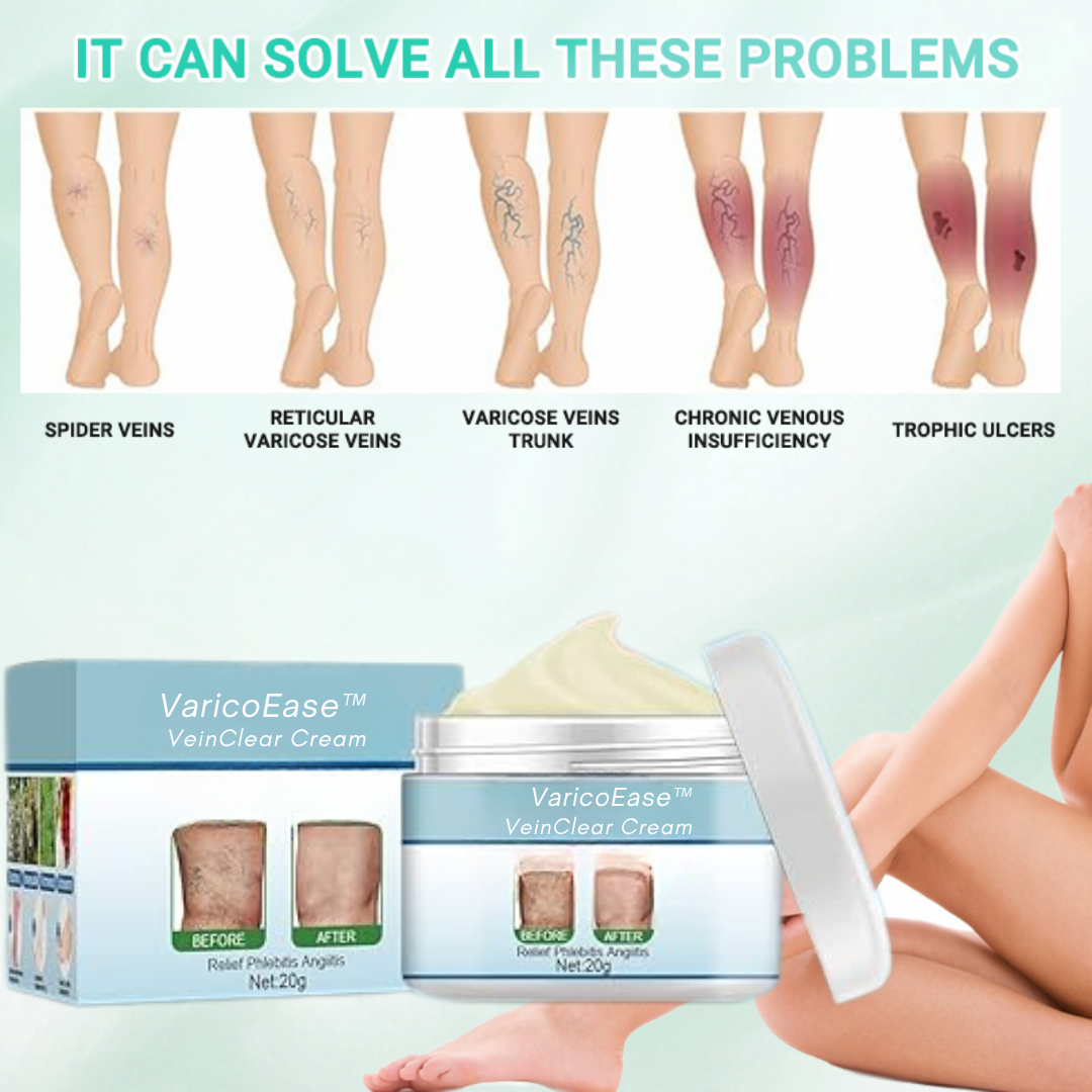 VaricoEase™ - VeinClear Cream - Reducerer synligt åreknuder og hjælper dig med at få glatte, sunde ben på bare 7 dage! (1+1 GRATIS)