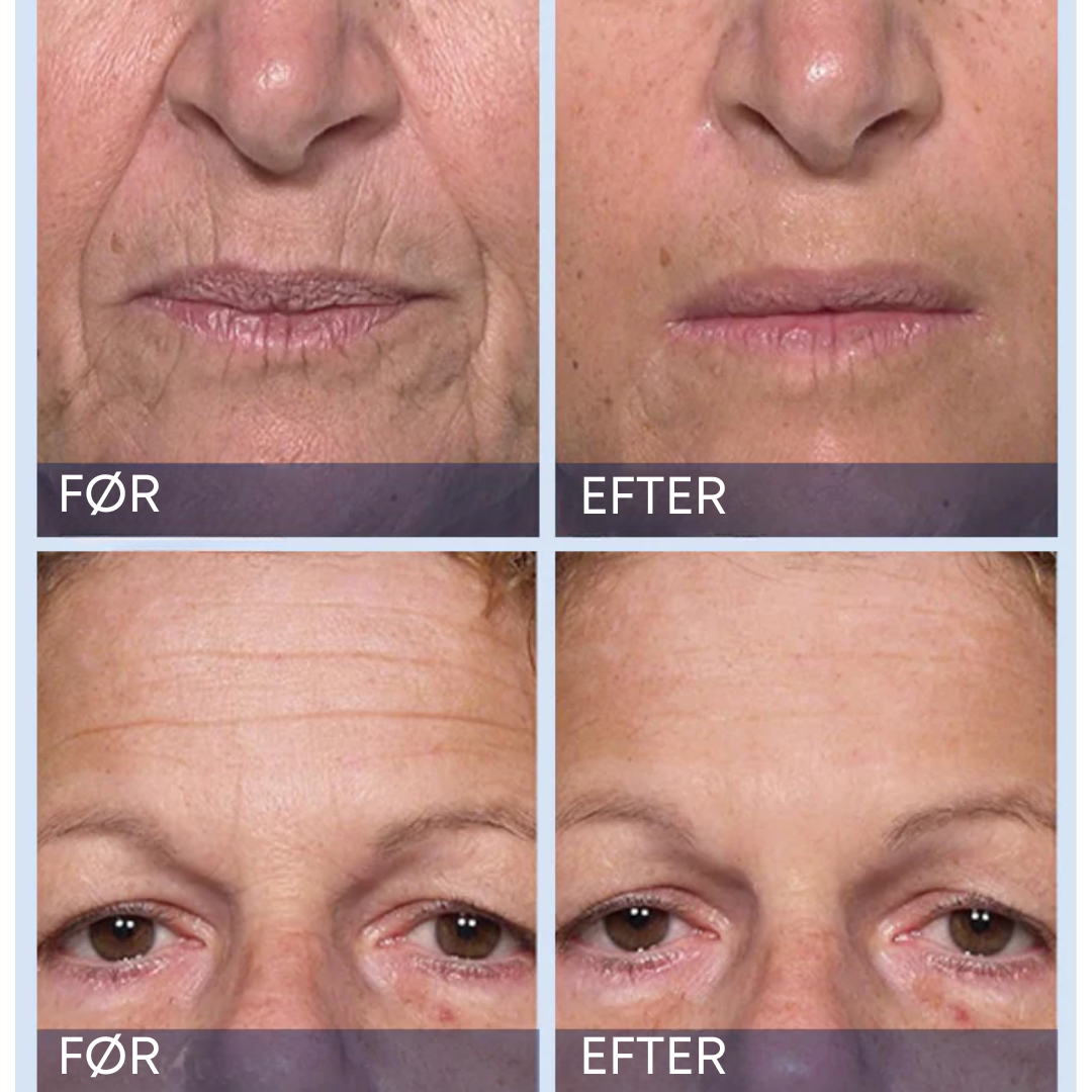 Furzero UngdomsBoost Elixer™ | Forynger din hud og giver et øjeblikkeligt løft