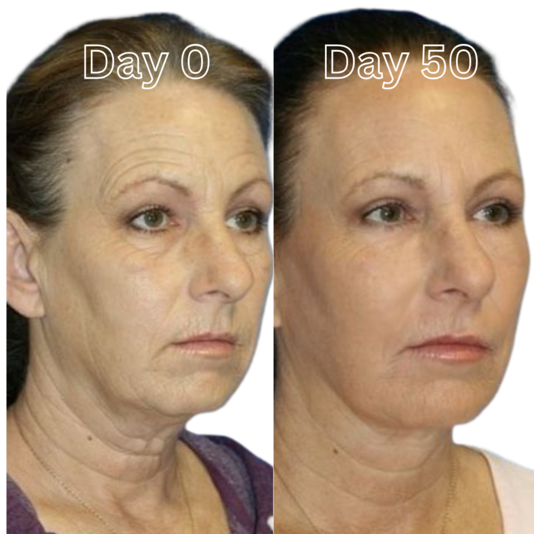 GlasHud™ – Silkeblød hud med ét brug