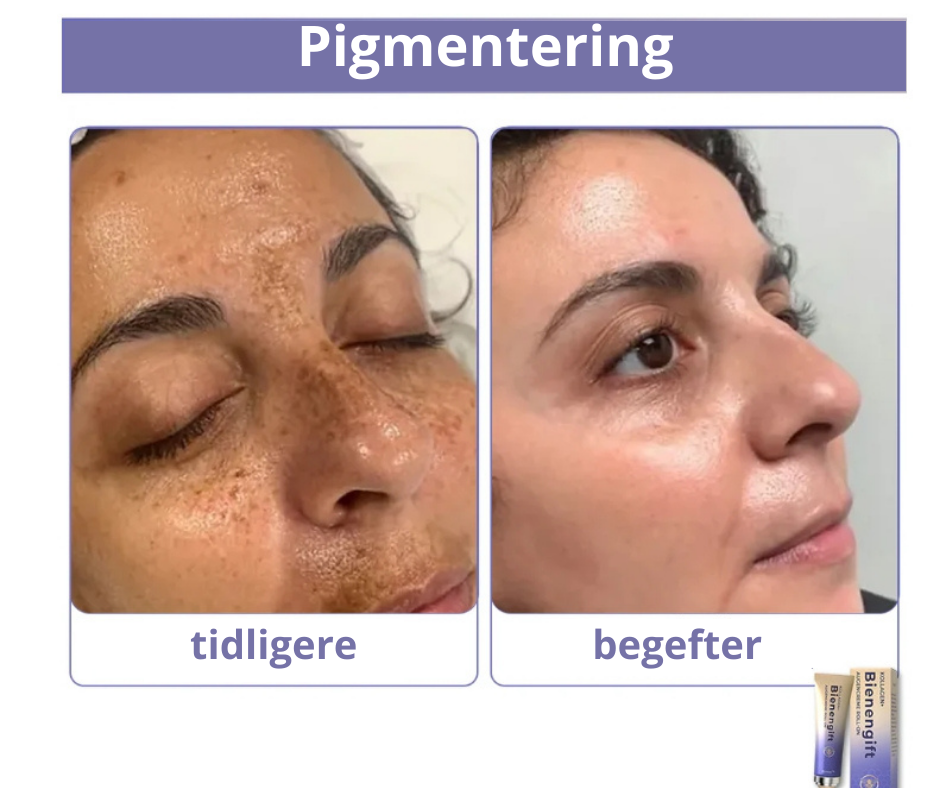 BioBee™ – Styrk din hud med naturens kraft