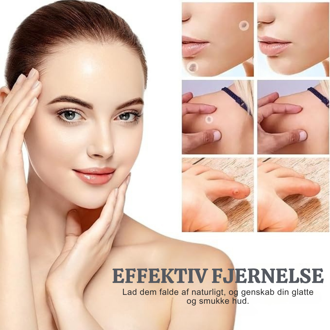 TagVæk™ – Fjern hudmærker på kun 5 dage