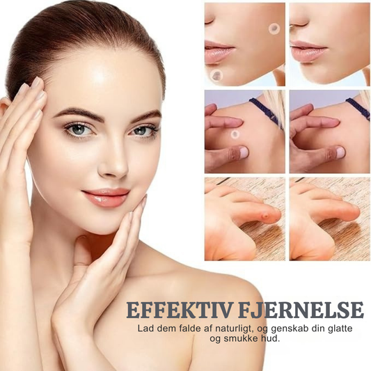 TagVæk™ – Fjern hudmærker på kun 5 dage