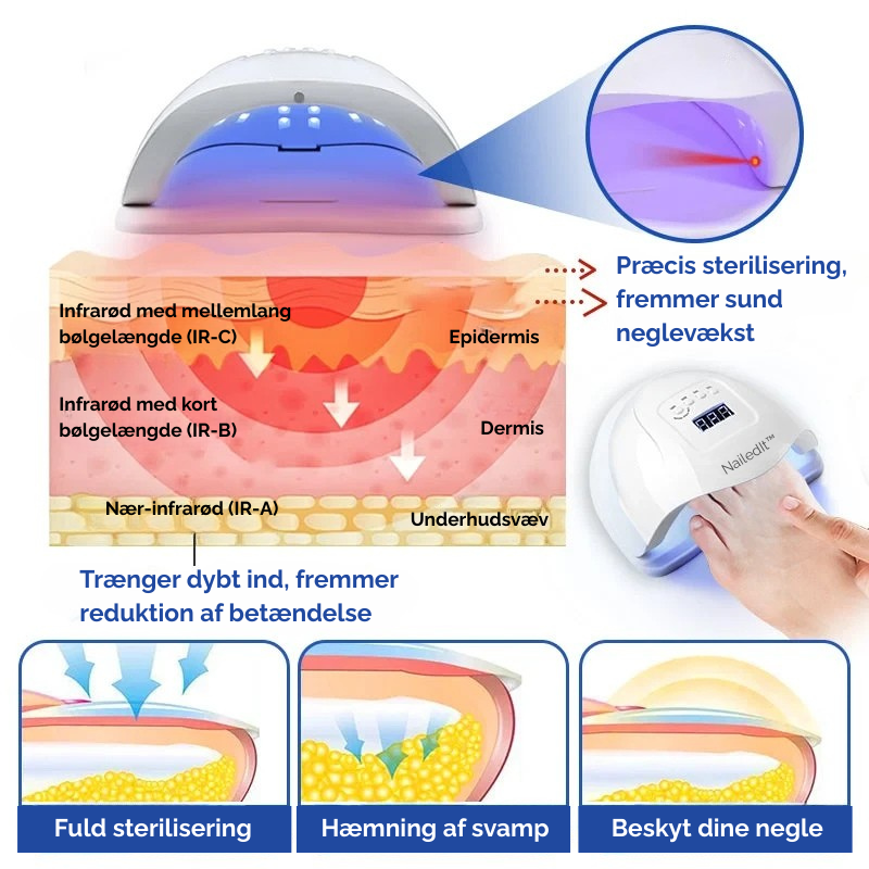 MycoLight™ Skånsom behandling mod neglesvamp