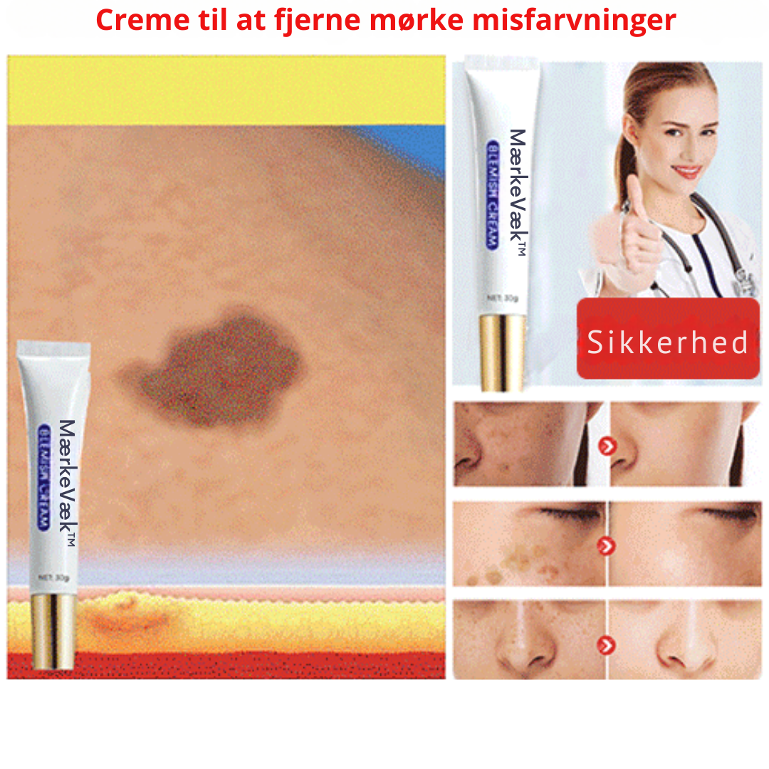 MærkeVæk™ – Fjern pletter & mærker på få dage