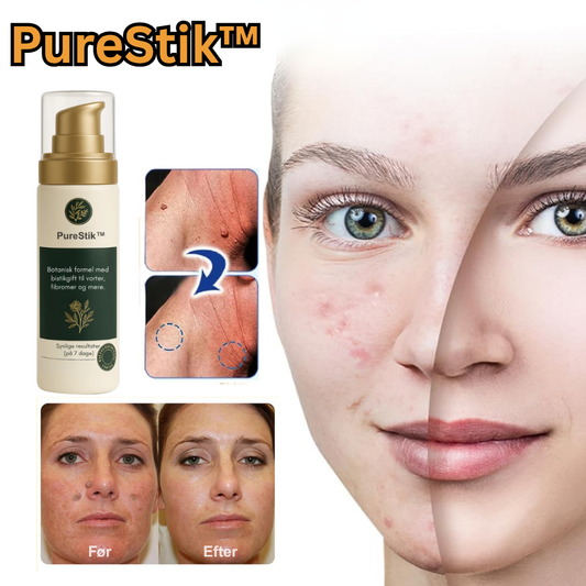 PureStik™ | Farvel til hudmærker og rynker med bi-gift – hjemmefra på få dage!