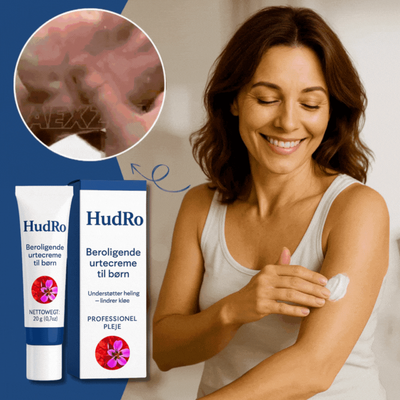 HudRo™ Psoriasiscreme | Lindrer psoriasis og eksem med op til 94 % på kun 3 dage!
