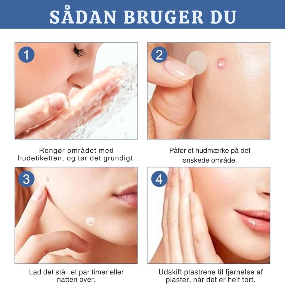 TagVæk™ – Fjern hudmærker på kun 5 dage