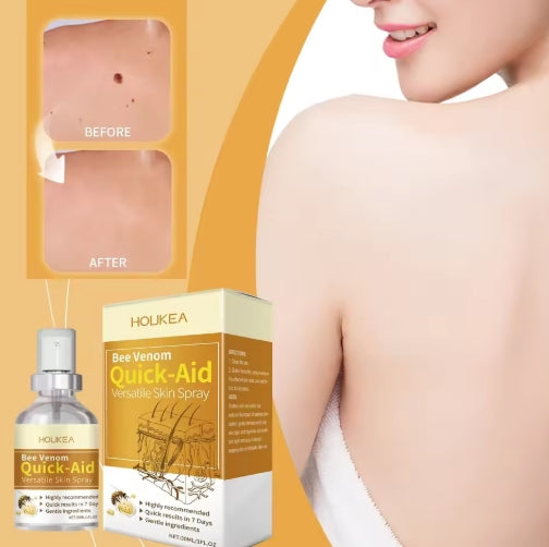 SkinPure™ – Spray til Urenheder & Vorter