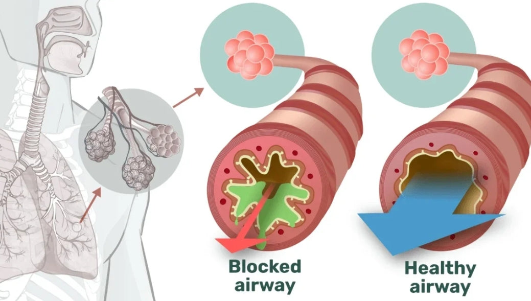 LungeRen™ – Naturlig Lungedetox Spray