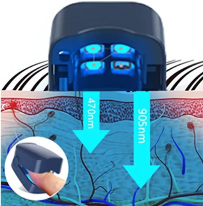 LumiNail™ - Slip af med tykke, misfarvede negle én gang for alle!