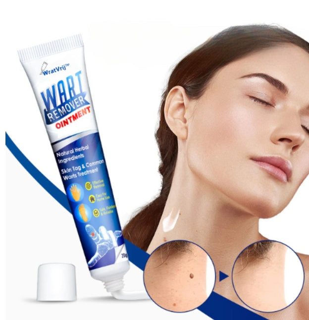 Wratvrij™ Vortefjerner - Fjern alle dine vorter smertefrit på kun 7 dage!